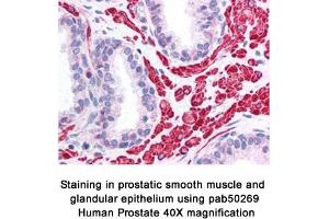 Image no. 1 for anti-Optic Atrophy 1 (Autosomal Dominant) (OPA1) (AA 500-600), (Internal Region) antibody (ABIN363578) (OPA1 抗体  (Internal Region))