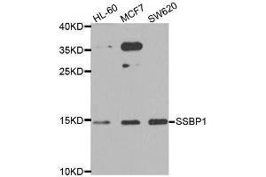 Western blot analysis of extracts of various cell lines, using SSBP1 antibody. (SSBP1 抗体  (AA 1-148))