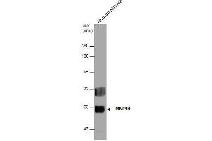 WB Image MMP10 antibody detects MMP10 protein by western blot analysis. (MMP10 抗体)