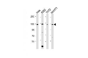 All lanes : Anti-ROR2 Antibody (C-term) at 1:2000 dilution Lane 1: Hela whole cell lysate Lane 2: K562 whole cell lysate Lane 3: T47D whole cell lysate Lane 4: NIH/3T3 whole cell lysate Lysates/proteins at 20 μg per lane. (ROR2 抗体  (C-Term))