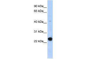 WB Suggested Anti-C16orf80 Antibody Titration:  0.