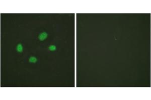Immunofluorescence analysis of HeLa cells, using Chk2 (Phospho-Thr383) antibody. (CHEK2 抗体  (pThr383))
