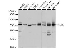 Western blot analysis of extracts of various cell lines, using  antibody (ABIN6131387, ABIN6136467, ABIN6136469 and ABIN6222130) at 1:1000 dilution. (ACSS2 抗体)