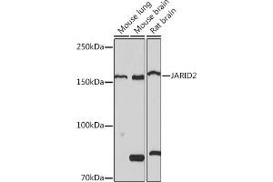 Western blot analysis of extracts of various cell lines, using J Rabbit mAb (ABIN7268047) at 1:1000 dilution. (JARID2 抗体)