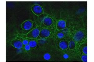 Immunofluorescence of cultured rat neurons and glia showing axonal and dendritic staining of alpha II spectrin (green) revealing the submembranous cytoskeleton and DNA (blue). (SPTAN1 抗体)