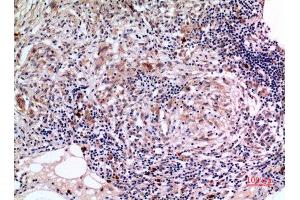Immunohistochemistry (IHC) analysis of paraffin-embedded Human Lung, antibody was diluted at 1:100. (SCCA1/2 (Internal Region) 抗体)