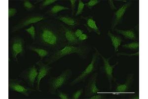 Immunofluorescence of purified MaxPab antibody to CYTH2 on HeLa cell. (Cytohesin 2 抗体  (AA 1-400))