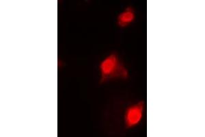 Immunofluorescent analysis of RAD51C staining in HeLa cells. (RAD51C 抗体  (Center))