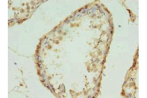 Immunohistochemistry of paraffin-embedded human testis tissue using ABIN7142361 at dilution of 1:100 (MRPL18 抗体  (AA 14-180))