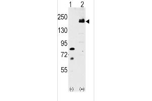 Western blot analysis of LRP6 (arrow) using rabbit polyclonal LRP6 Antibody (C-term ) (ABIN390100 and ABIN2840612). (LRP6 抗体  (C-Term))