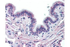 Anti-MUC13 antibody IHC of human lung, respiratory epithelium. (MUC13 抗体  (Extracellular Domain))