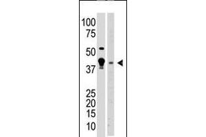 Antibody is used in Western blot to detect MBD2 in A375 cell lysate (lane 1) and mouse brain tissue lysate (lane 2) lysate. (MBD2 抗体  (N-Term))