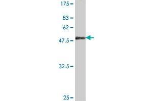 Western Blot detection against Immunogen (50. (PSMB9 抗体  (AA 1-219))