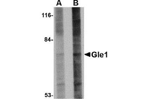 Western Blotting (WB) image for anti-GLE1 RNA Export Mediator (GLE1) (Middle Region) antibody (ABIN1030940) (GLE1 抗体  (Middle Region))