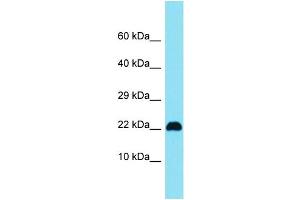 Host: Rabbit Target Name: C15orf32 Sample Type: Jurkat Whole Cell lysates Antibody Dilution: 1. (C15ORF32 抗体  (N-Term))