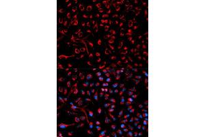 Immunofluorescence analysis of HeLa cell using DOK4 antibody. (DOK4 抗体  (AA 240-326))