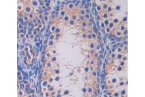 IHC-P analysis of Human Tissue, with DAB staining. (SLC26A8 抗体  (AA 664-970))