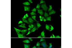 Immunofluorescence analysis of A549 cells using ENTPD2 Polyclonal Antibody (ENTPD2 抗体)