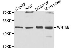 Western blot analysis of extract of various cells, using WNT5B antibody. (WNT5B 抗体)