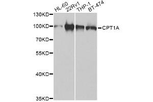 Western blot analysis of extracts of various cell lines, using CPT1A Antibody (ABIN1876495) at 1:1000 dilution. (CPT1A 抗体)