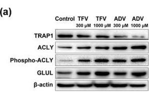 Western Blotting (WB) image for anti-TNF Receptor-Associated Protein 1 (TRAP1) antibody (ABIN2855258)