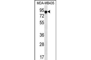 FYB Antibody (C-term) (ABIN656241 and ABIN2845557) western blot analysis in MDA-M cell line lysates (35 μg/lane). (FYB 抗体  (C-Term))