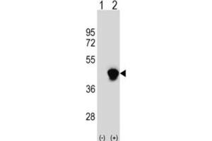 Western Blotting (WB) image for anti-Enoyl-CoA Delta Isomerase 2 (PECI) antibody (ABIN3003871) (PECI/ECI2 抗体)