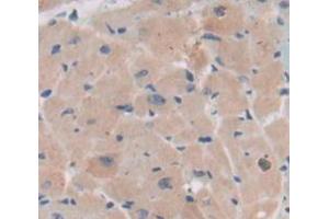 Used in DAB staining on fromalin fixed paraffin- embedded Kidney tissue (BMX 抗体  (AA 209-446))
