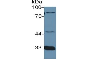Mouse Capture antibody from the kit in WB with Positive Control: Human urine. (Prothrombin Fragment 1+2 ELISA 试剂盒)