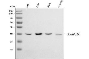 Western blot analysis of RAD51C using anti-RAD51C antibody (ABIN7599718).