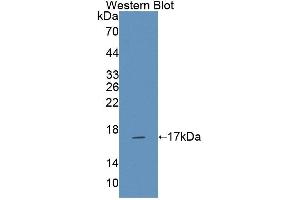 Western blot analysis of the recombinant protein. (NCR3 抗体  (AA 21-147))
