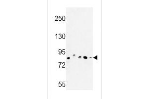 Western blot analysis of CHPF Antibody in MDA-MB435, MCF-7, HepG2, A375 cell line and mouse testis tissue lysates (35ug/lane) (CHPF 抗体  (AA 327-354))