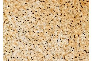 ABIN6265345 and ABIN6277877 at 1/100 staining Mouse pancreatic tissue by IHC-P. (STK4 抗体  (C-Term))