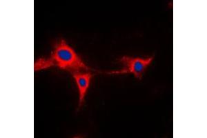 Immunofluorescence (IF) image for anti-Cytochrome P450, Family 2, Subfamily A, Polypeptide 13 (CYP2A13) (Center) antibody (ABIN7295438)