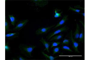 Immunofluorescence of purified MaxPab antibody to KLK7 on HeLa cell. (Kallikrein 7 抗体  (AA 1-253))