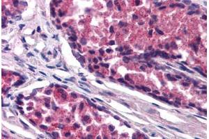 Human Prostate (formalin-fixed, paraffin-embedded) stained with SNX26 antibody ABIN290201 at 1. (SNX26 抗体  (AA 3-14))