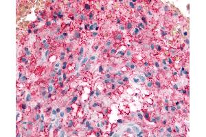 Immunohistochemistry (IHC) image for anti-Potassium Large Conductance Calcium-Activated Channel, Subfamily M beta Member 3 (KCNMB3) (C-Term) antibody (ABIN1048990)