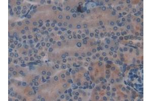 Immunohistochemistry (IHC) image for anti-Cysteine-Rich, Angiogenic Inducer, 61 (CYR61) (AA 176-379) antibody (ABIN7439291)
