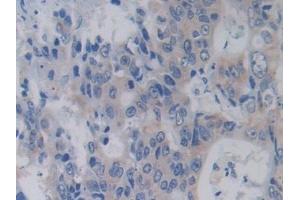 Immunohistochemistry (IHC) image for anti-Arginyl-tRNA Synthetase (RARS) (AA 1-146) antibody (ABIN7435304)