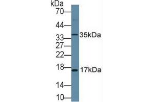 Rabbit Detection antibody from the kit in WB with Positive Control: Human placenta tissue.