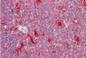 ABIN768629 (5µg/ml) staining of paraffin embedded Human Tonsil. (PDXP 抗体  (C-Term))