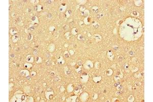 Immunohistochemistry of paraffin-embedded human brain tissue using ABIN7146119 at dilution of 1:100 (CXCL11 抗体  (AA 22-94))
