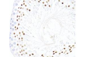 Immunohistochemistry of paraffin-embedded Rat testis using DDX59 Polyclonal Antibody at dilution of 1:100 (40x lens). (DDX59 抗体)