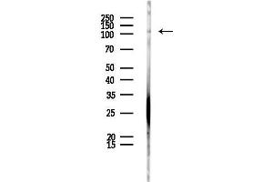 anti-Adaptor-Related Protein Complex 2, beta 1 Subunit (AP2B1) (N-Term) antibody