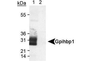 Western blot analysis of Gpihbp1 in transfected lysate (Lane 1) using Gpihbp1 polyclonal antibody . (GPIHBP1 抗体  (AA 170-250))
