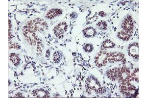 Immunohistochemical staining of paraffin-embedded Human breast tissue using anti-RNF113B mouse monoclonal antibody. (RNF113B 抗体)