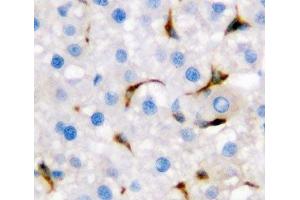 IHC-P: CD68 antibody testing of rat liver tissue (CD68 抗体  (AA 312-326))