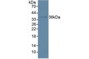Detection of IkBa in Human Hela Cells using Polyclonal Antibody to Inhibitory Subunit Of NF Kappa B Alpha (IkBa) (Inhibitory Subunit Of NF kappa B alpha (AA 74-247) 抗体)