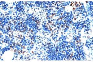 Immunohistochemistry of paraffin-embedded Rat spleen using AQR Polyclonal Antibody at dilution of 1:100 (40x lens). (AQR 抗体)