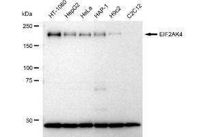 Western blotting analysis using EIF2AK4 antibody (ABIN7798505). (Recombinant GCN2 抗体)